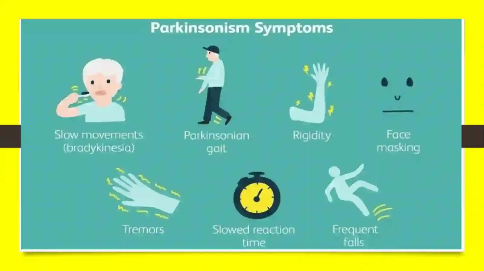 Neyrodegenerativ kasalliklar: Parkinson kasalligi 3