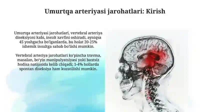 Umurtqa arteriyasi shikastlanishlari 3