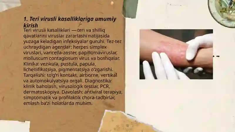 Terining virusli kasalliklari 3