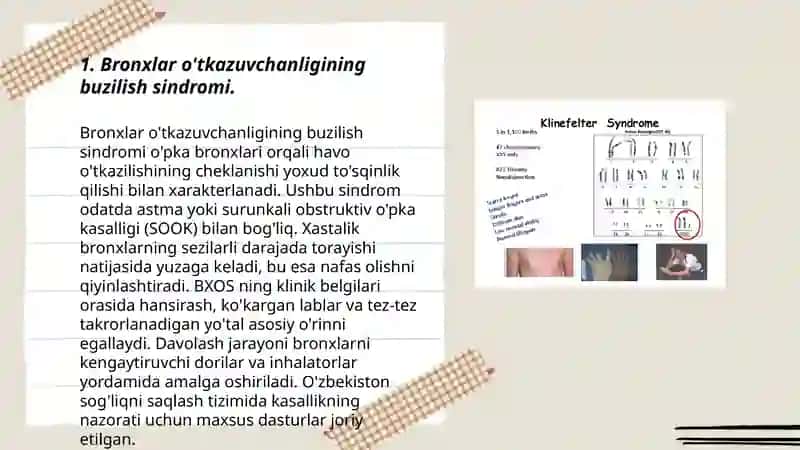 Bronxlar o'tkazuvchanligining buzilish sindromi 3