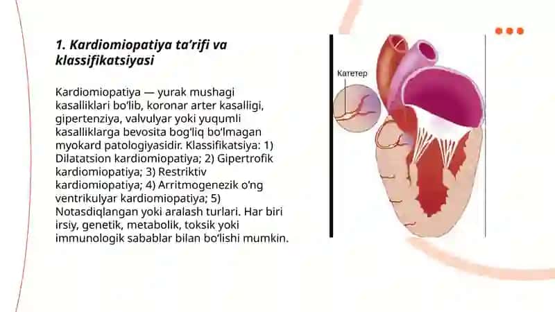 Kardiomiopatiya 3