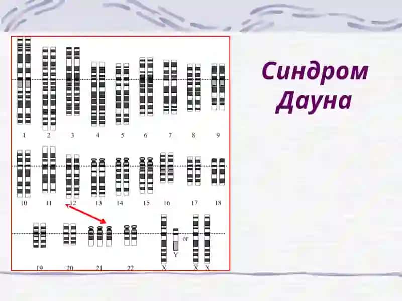 Пре- и перинатальная патология 3