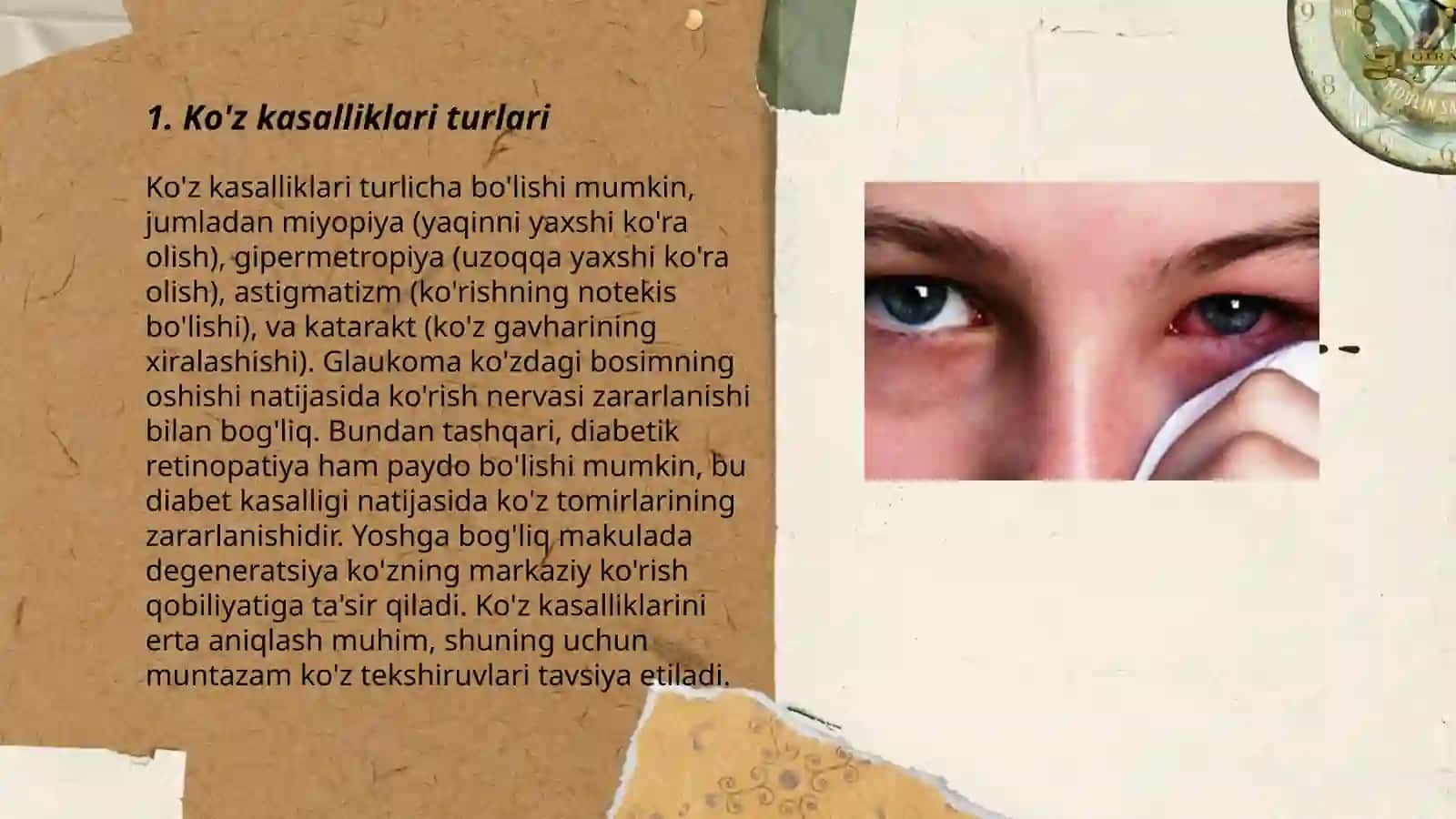 Ko'z kasaliklari va ularni davolash usulari 3
