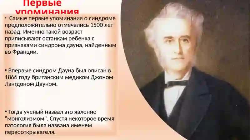 Синдром Дауна 3
