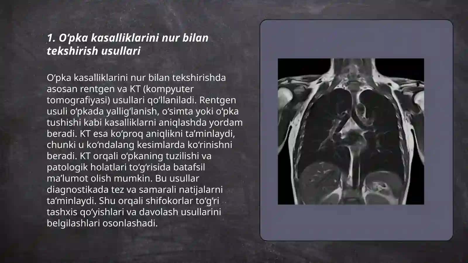 O‘pka va ko‘ks oralig‘i kasalliklari 3