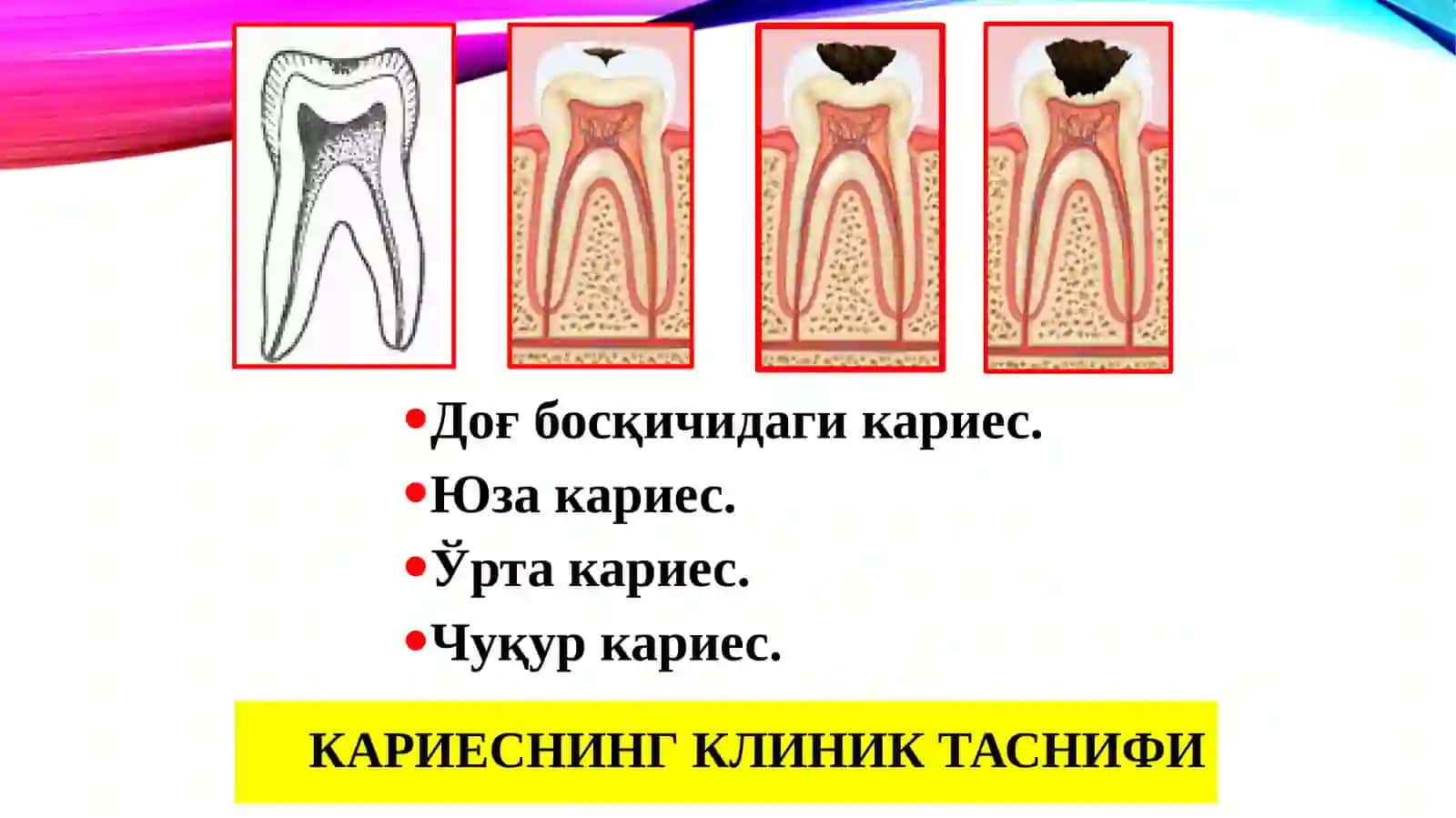Чархлашнинг минимал инвазив усуллари 3