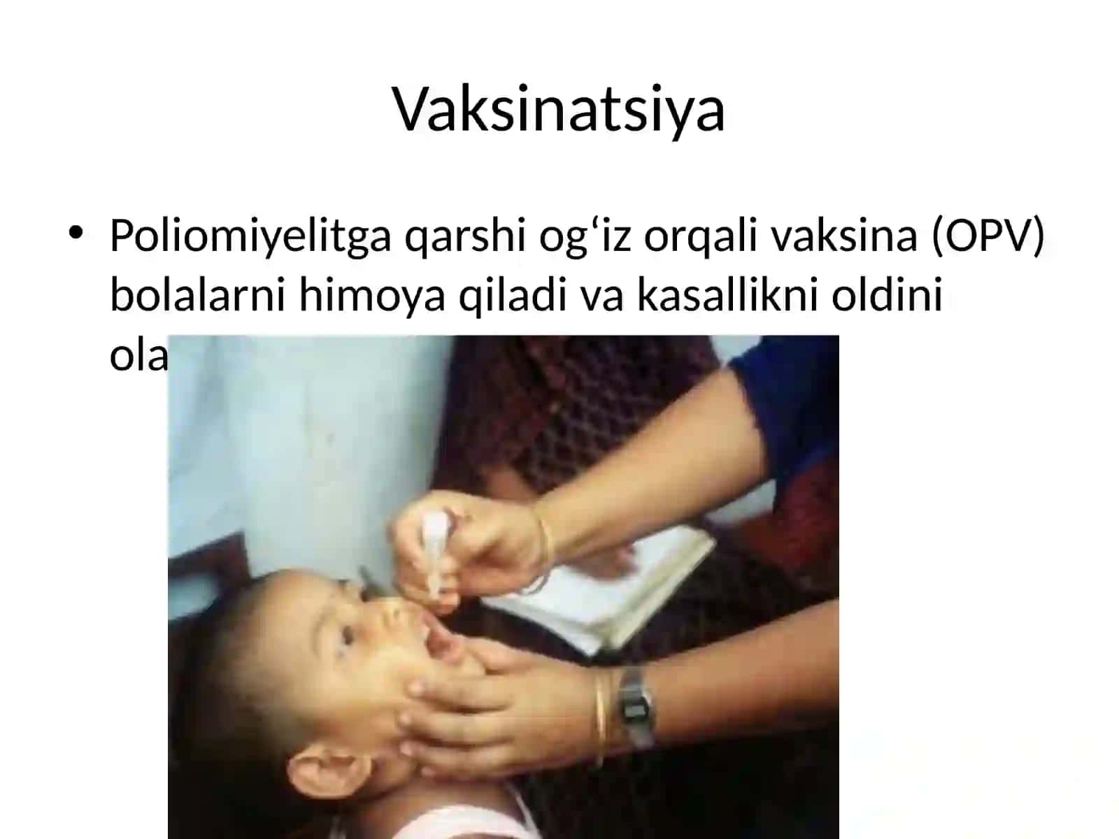 Poliomiyelit kasalligi 3