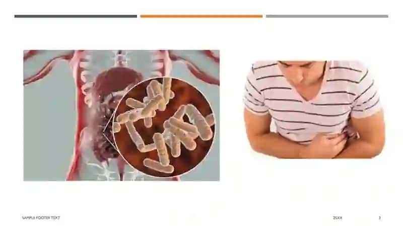 Surrunkali enterit etiologiyasi va patogenezi 3