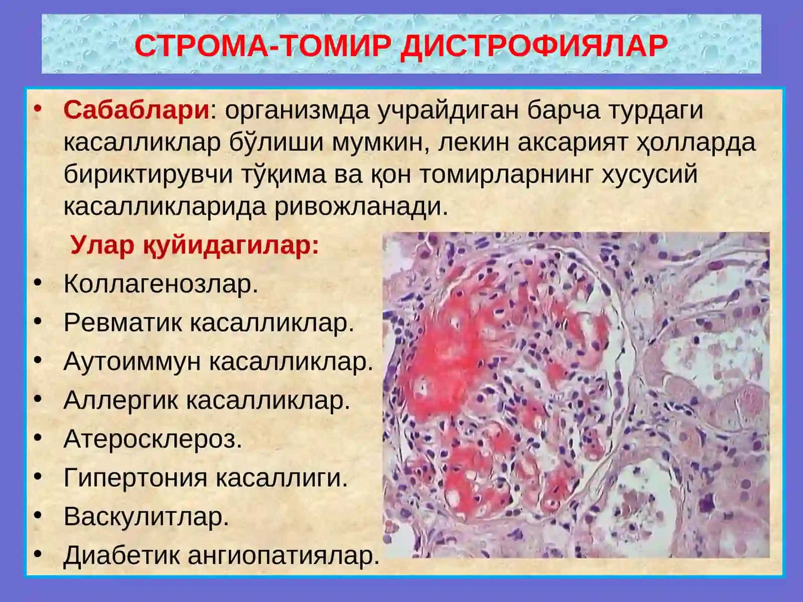 СТРОМА-ТОМИР ДИСТРОФИЯЛАР 3