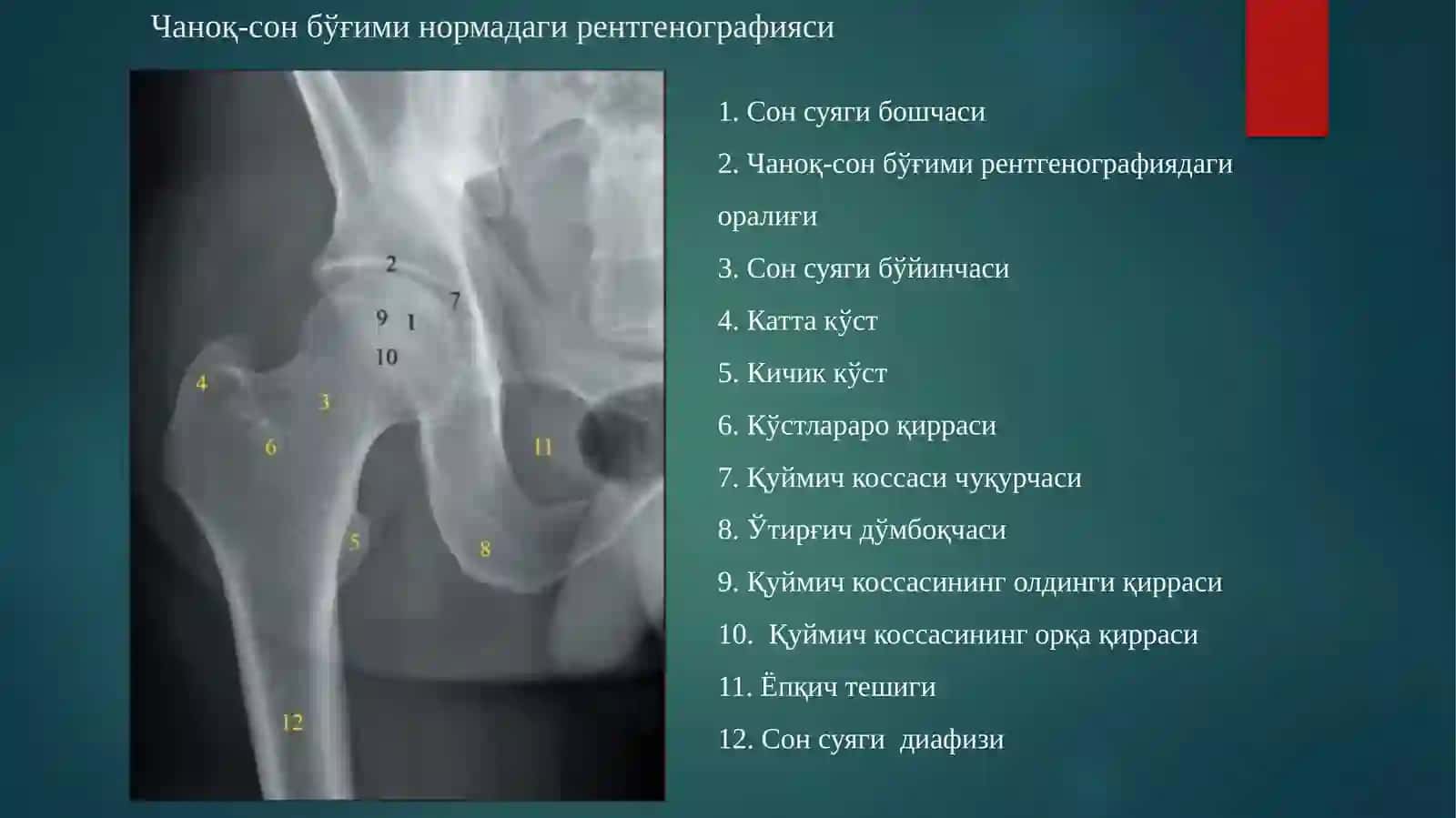 Оёқ суяқлари синишлари 3