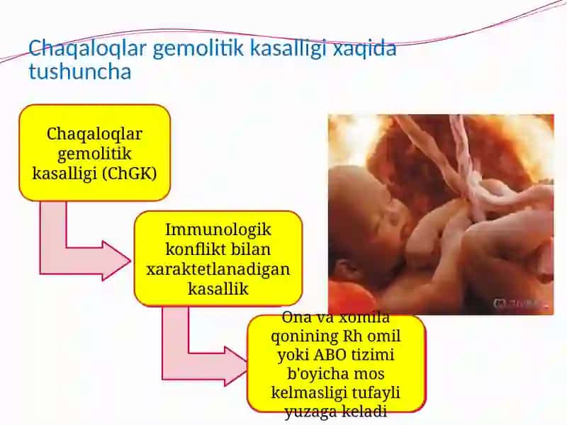 Chaqaloqlar gemolitik kasalligi 3