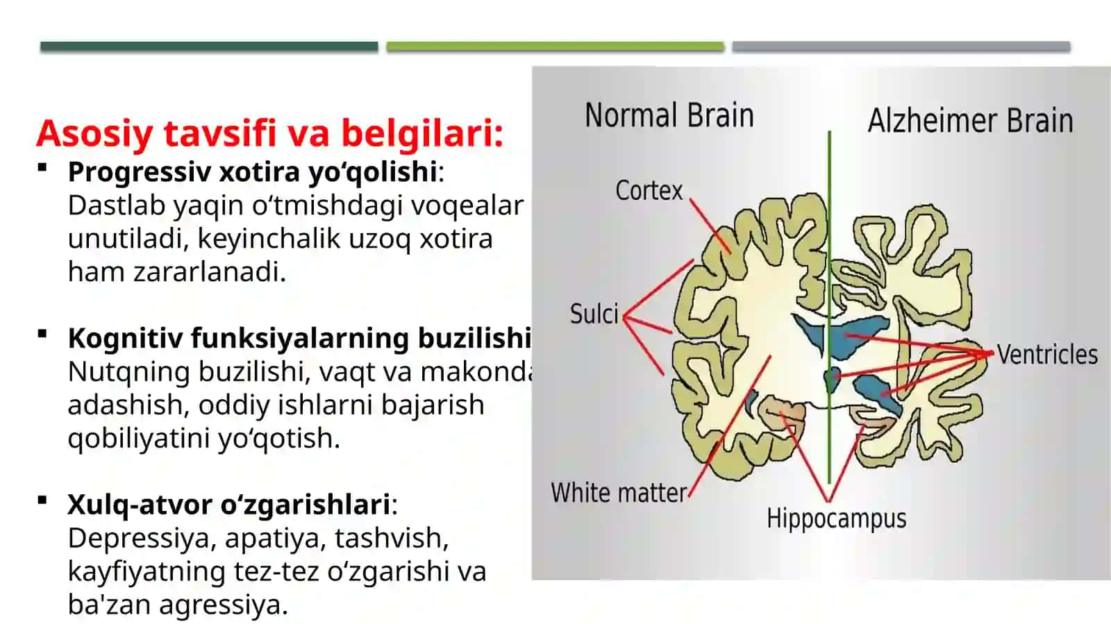 nerv sistemasining degenerativ kasalliklari 3