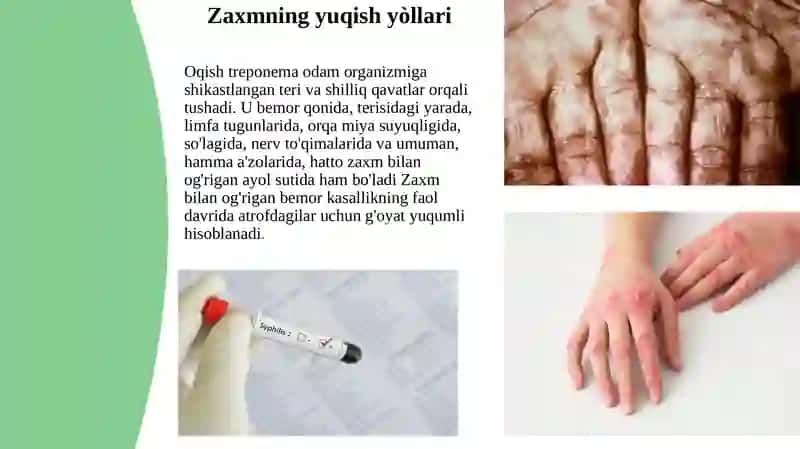ZAXM 3