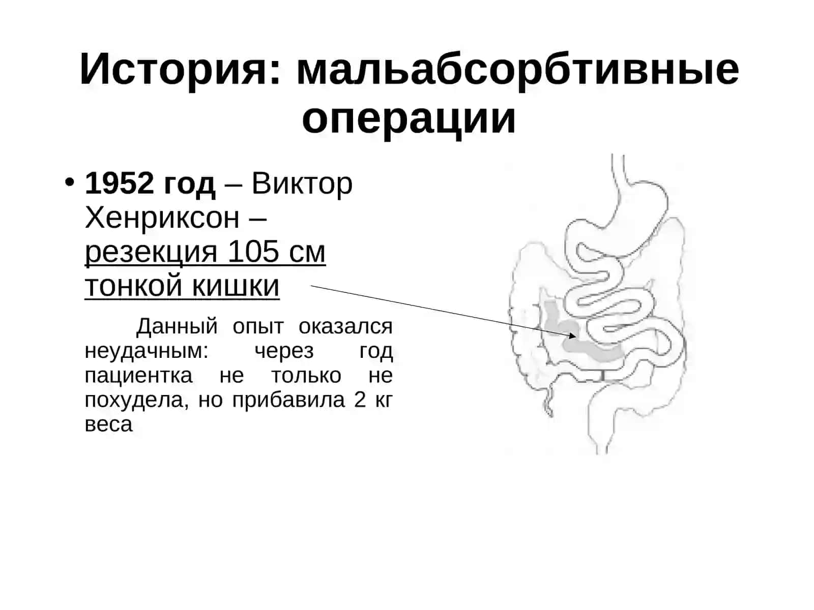 Основы бариатрической хирургии 3