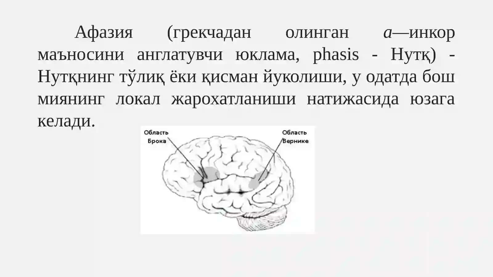 Афазия 3