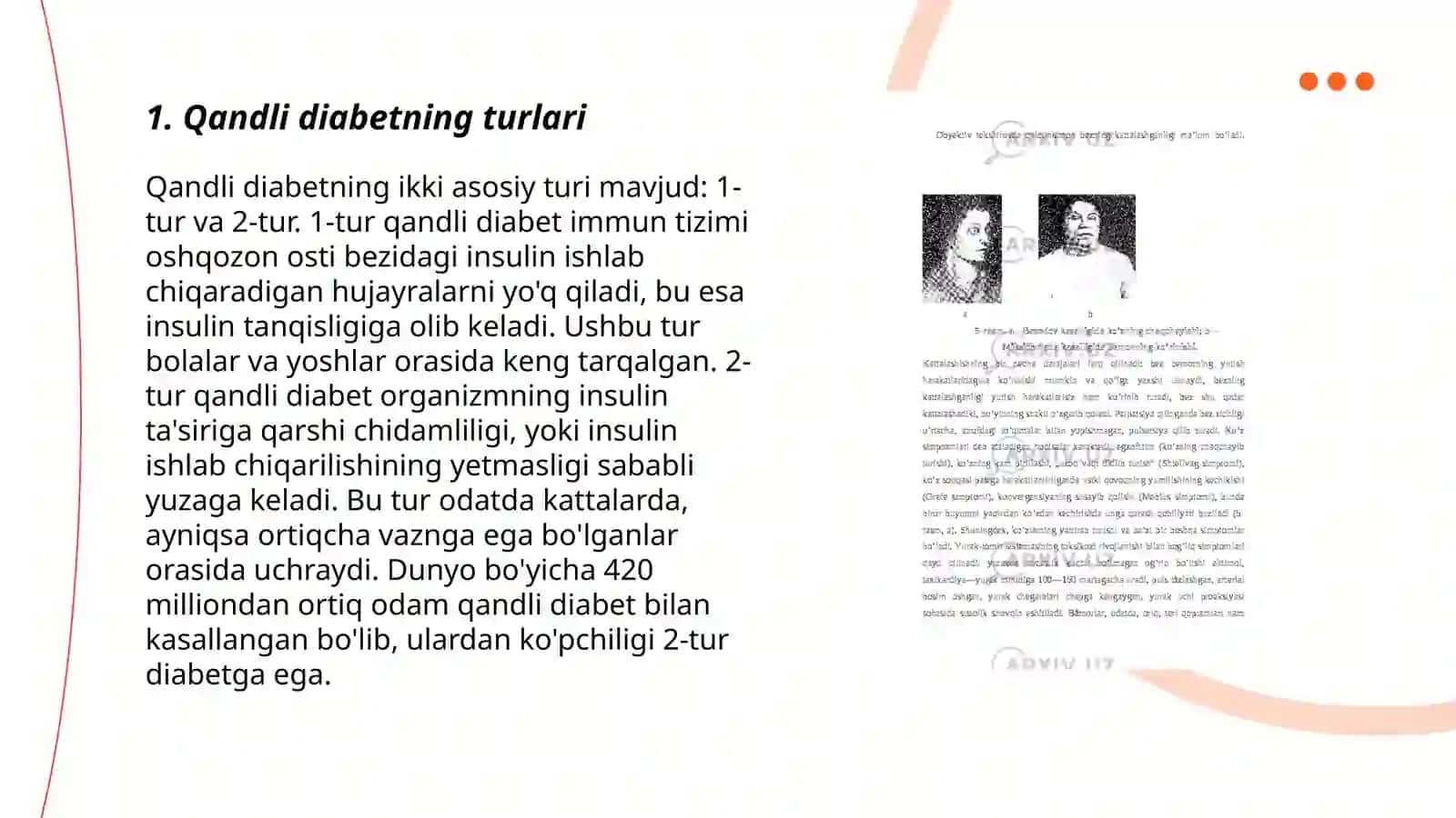 Qandli diabet kasalliklari 3