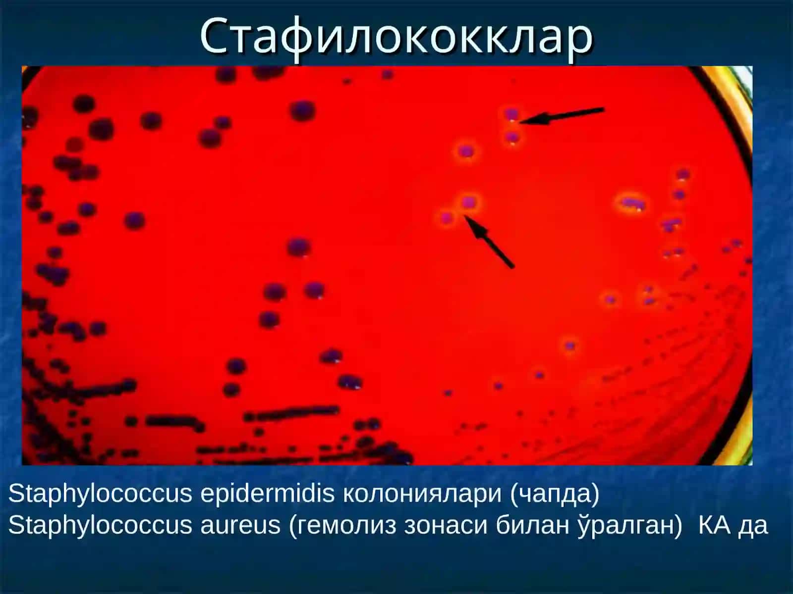 Patogenlik 3
