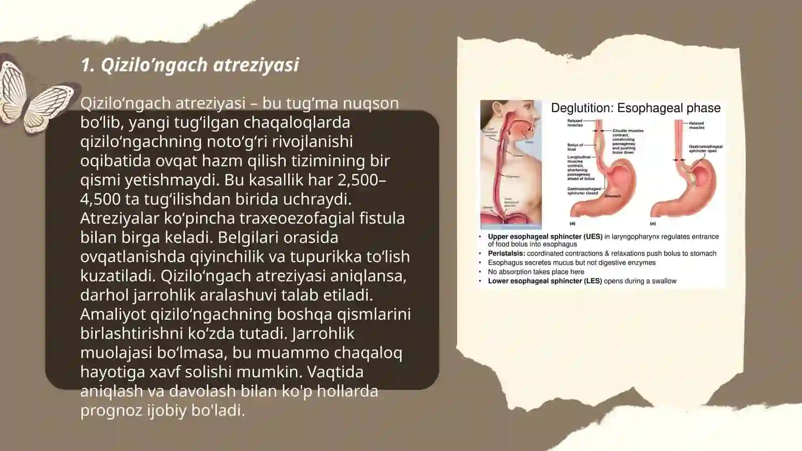 Qizilo’ngach atreziyasi 3