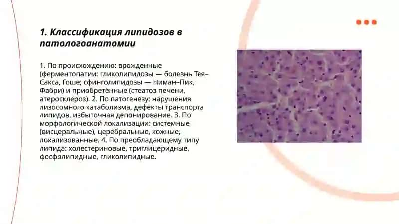 Липидозы патологическая анатомия 3