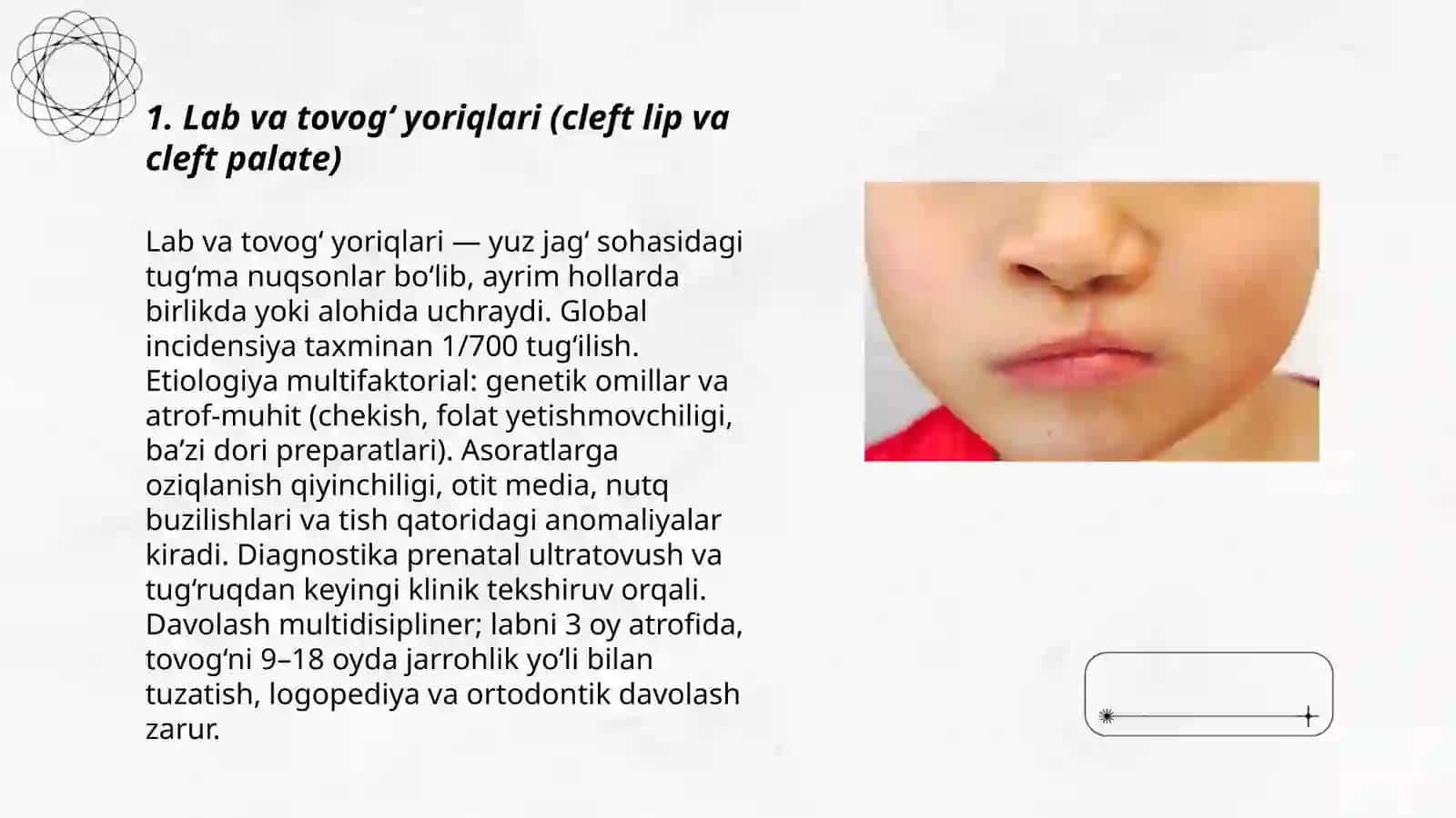 Lab va tovog‘ yoriqlari (cleft lip va cleft palate) 3