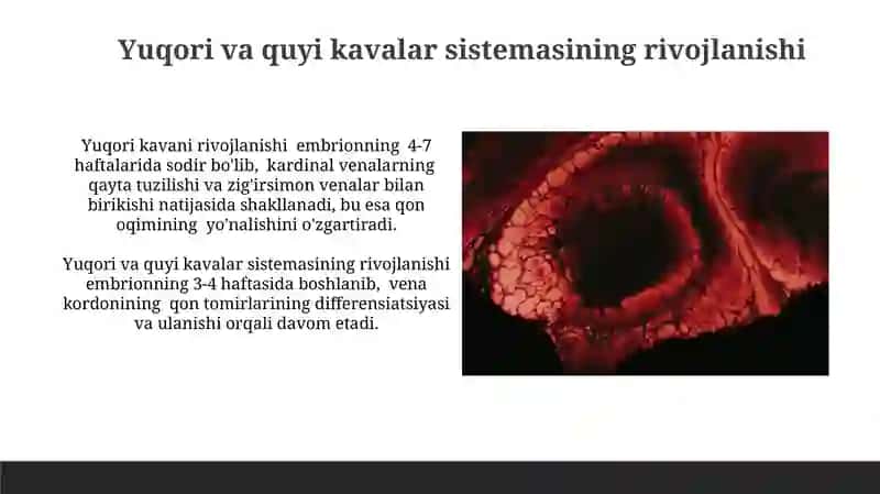Tanadagi yirik venoz tizimlarining rivojlanishi 3