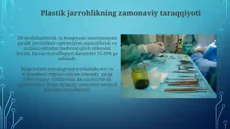 Plastik Jarrohlikning Zamonaviy Yutuqlari 3