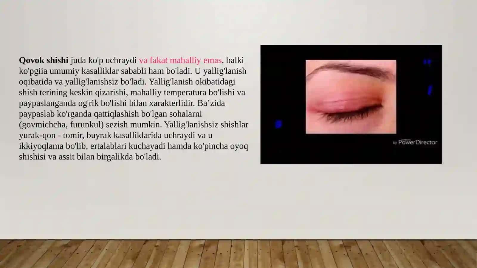 Qovoq tuzilishi va kassaliklar 3