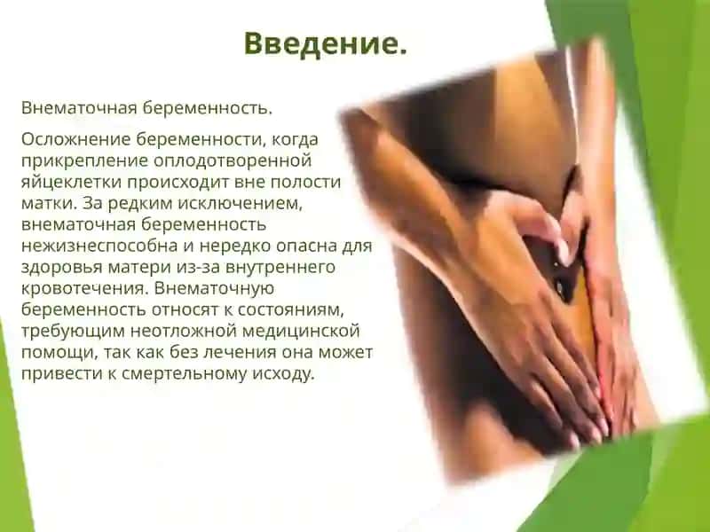 Внематочная беременность 3