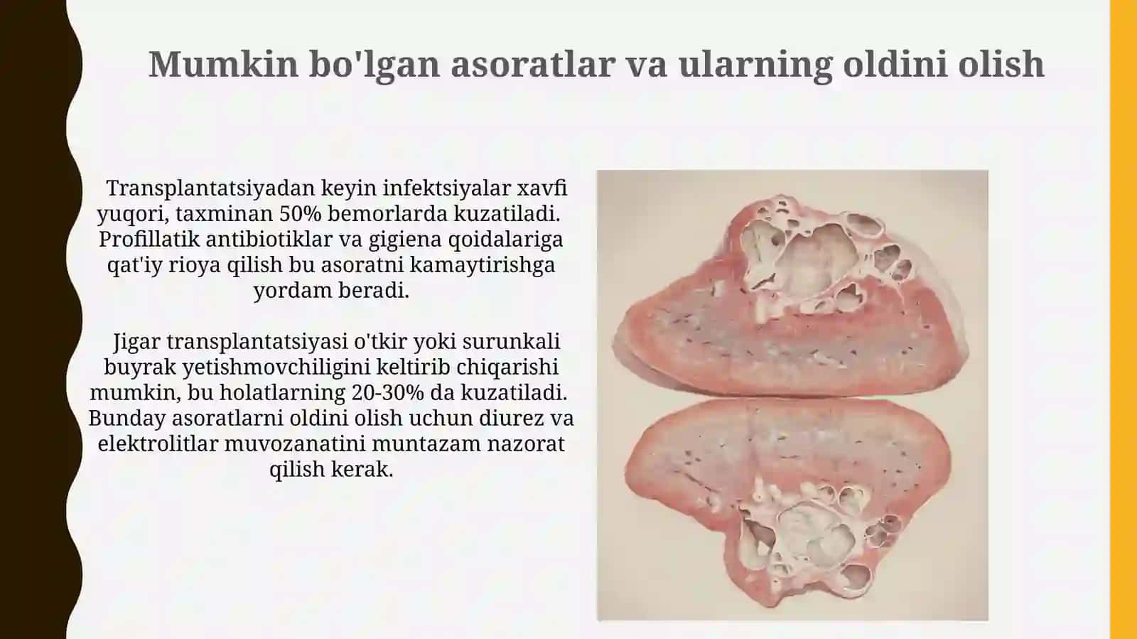 Jigar transplantatsiyasi 3