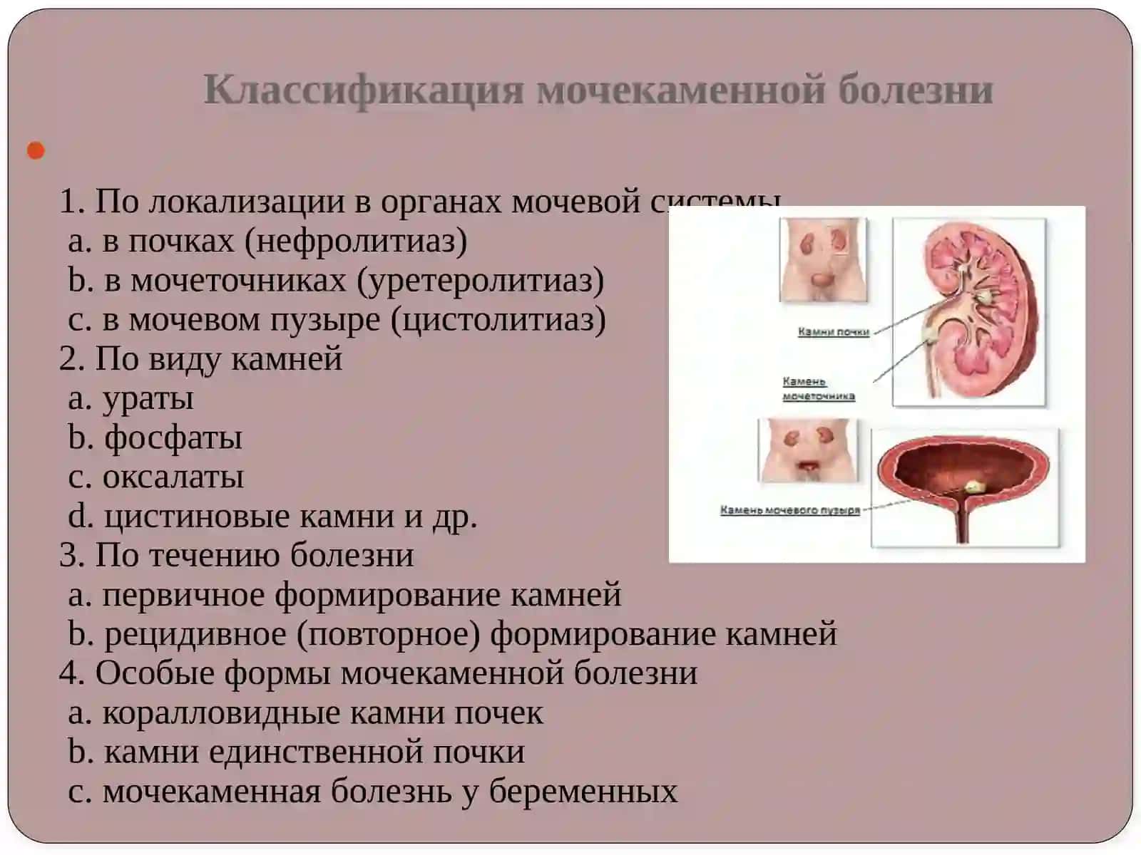 Мочекаменная болезнь 3