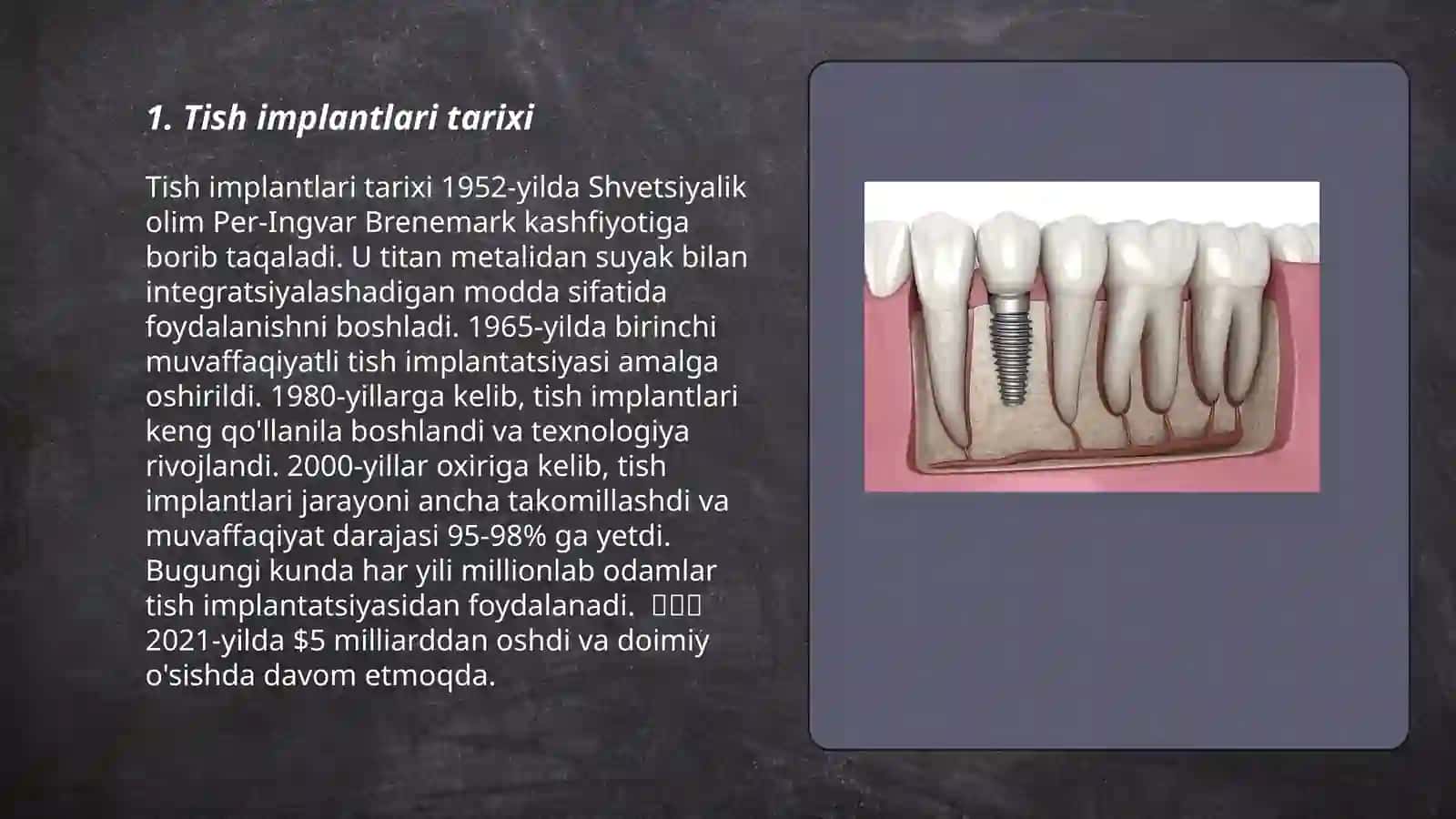 Tish Implantlari 3