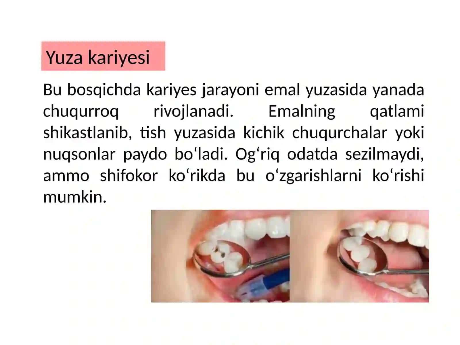KARIYES 3
