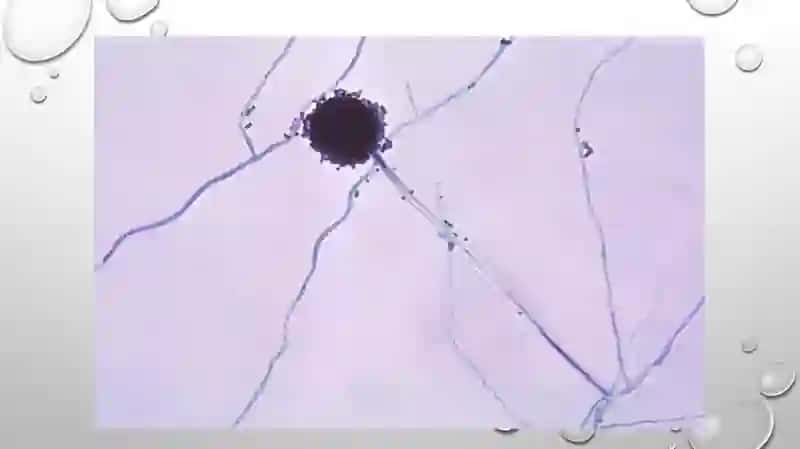 Aspergellusniger 3