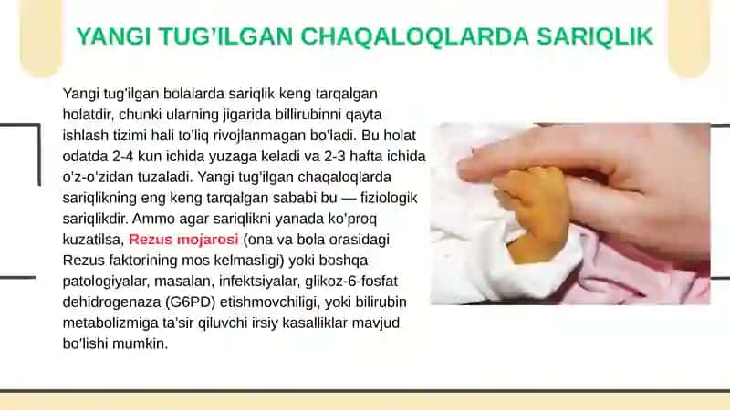 SARIQLIKGABOGʻLIQ SINDROMLAR 3