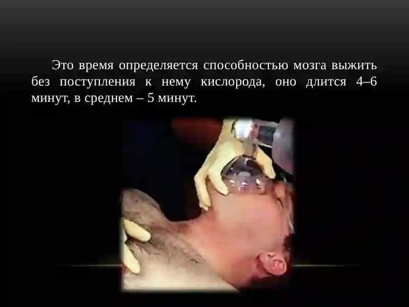 Клиническая и Биологическая смерть 3