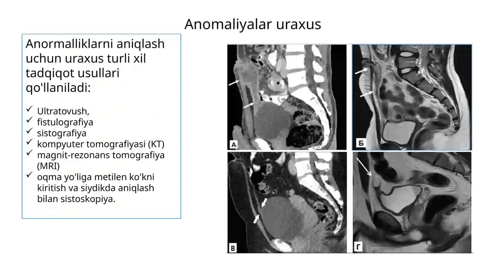 Anomaliyalar uraxus 3