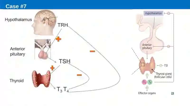 Endocrinology 3