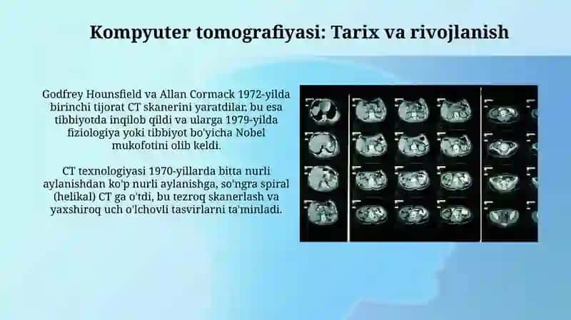 Kompyuter tomografiyasi 3