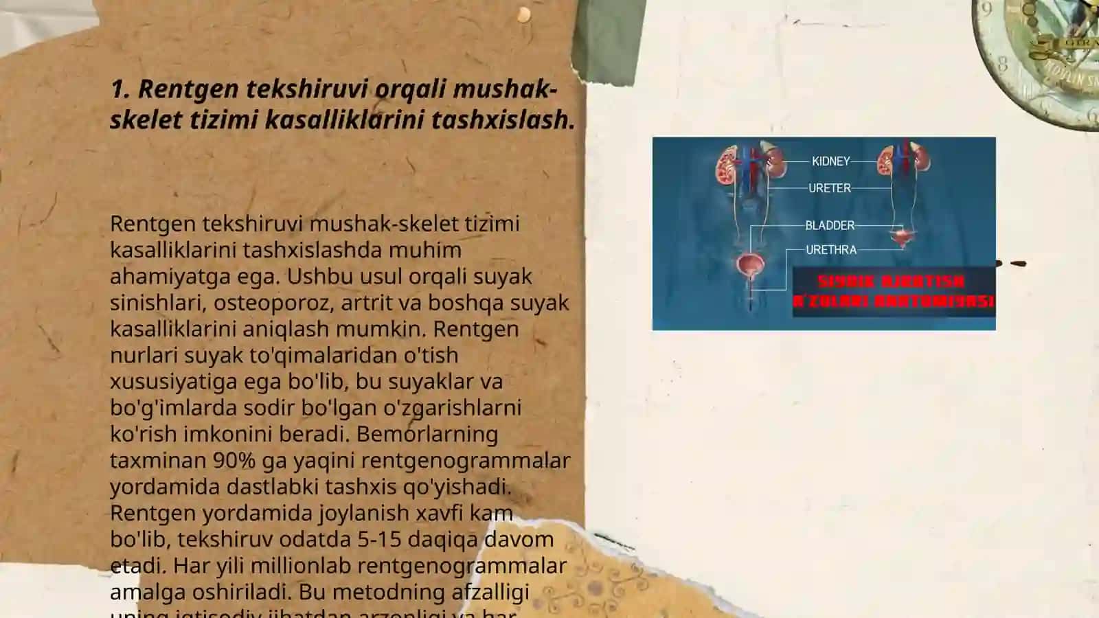 Mushak- skelet tizimining kasalliklarini tashxislash usullari 3