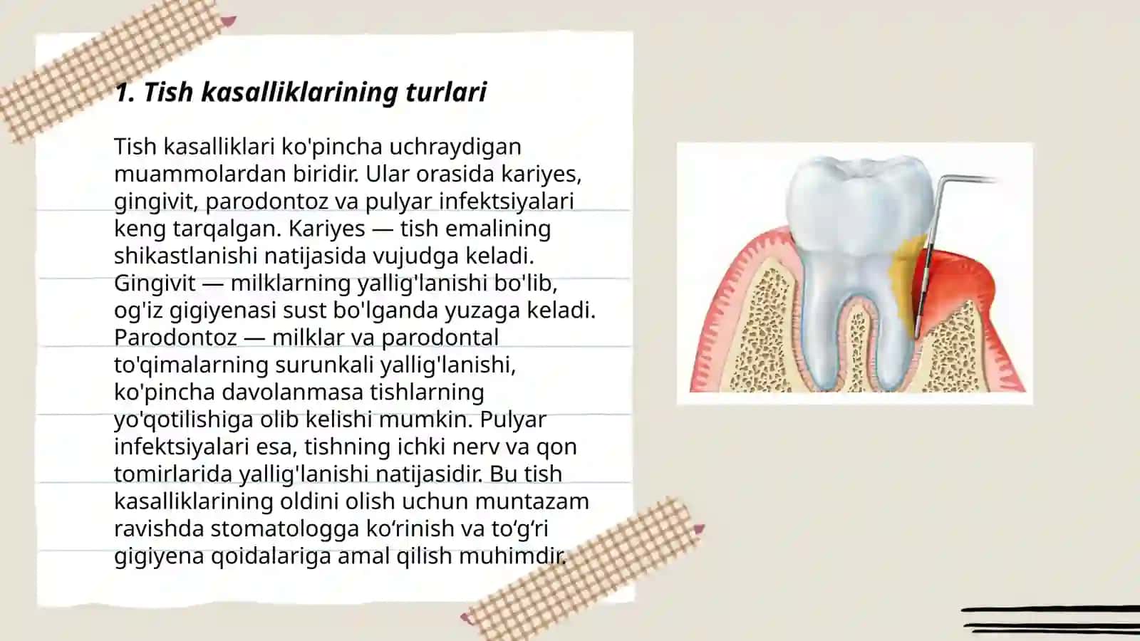 Tish kasalliklari kareis pulpit periodontit 3