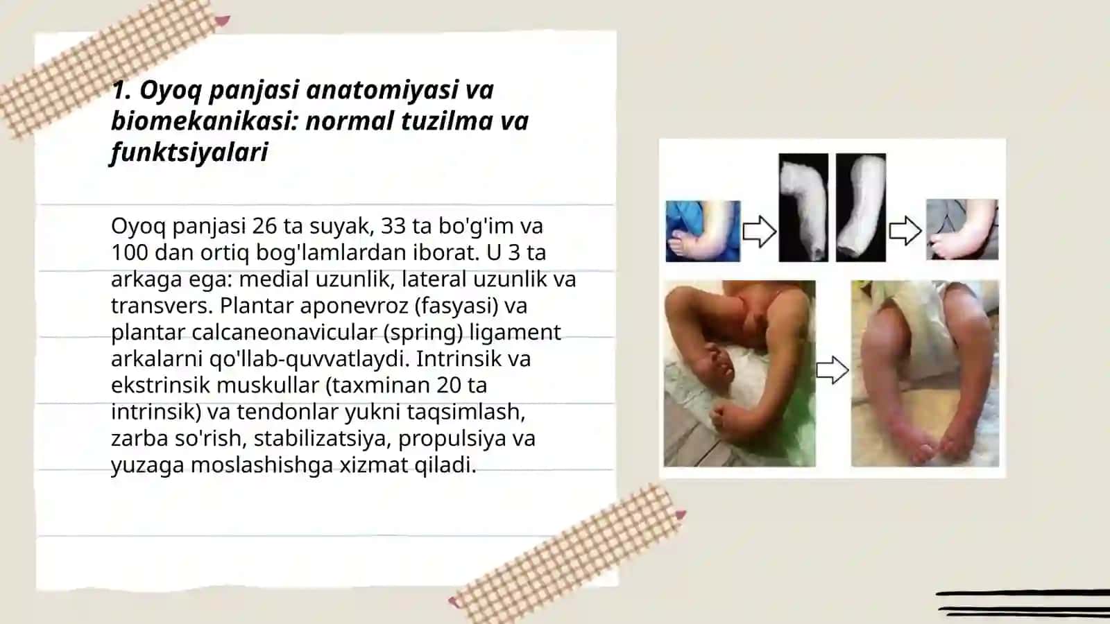 oyoq panjasi deformastiyalari va kasalliklari. yassioyoqlilik. maymoqlik etiologiyasi, patogenezi, tasnifi, klinikasi, diagnostikasi, zamonaviy davolas usullari 3