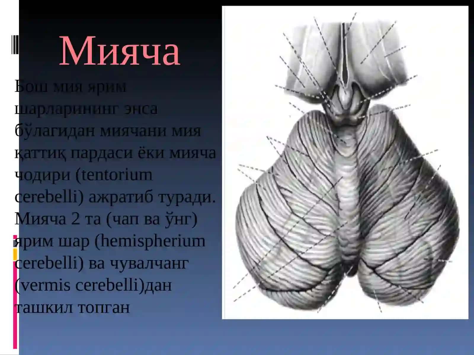 Мияча 3