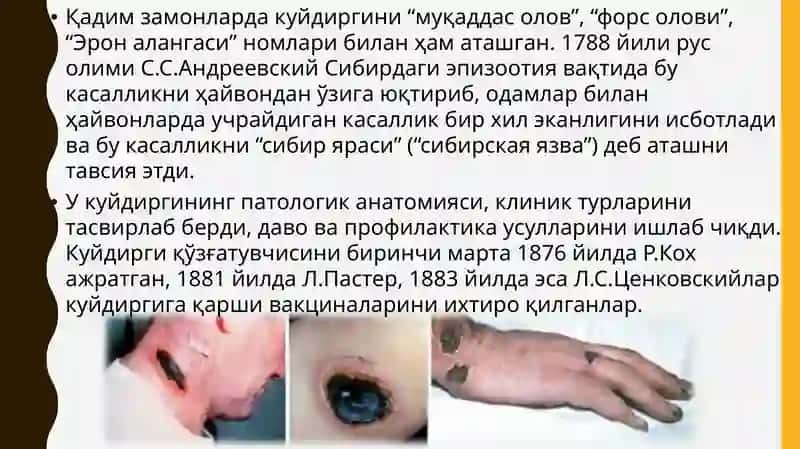 Куйдирги(сибиряраси) 3