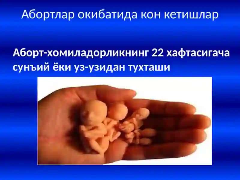 Хомиладорликнинг I ярмида    кон кетишлар 3