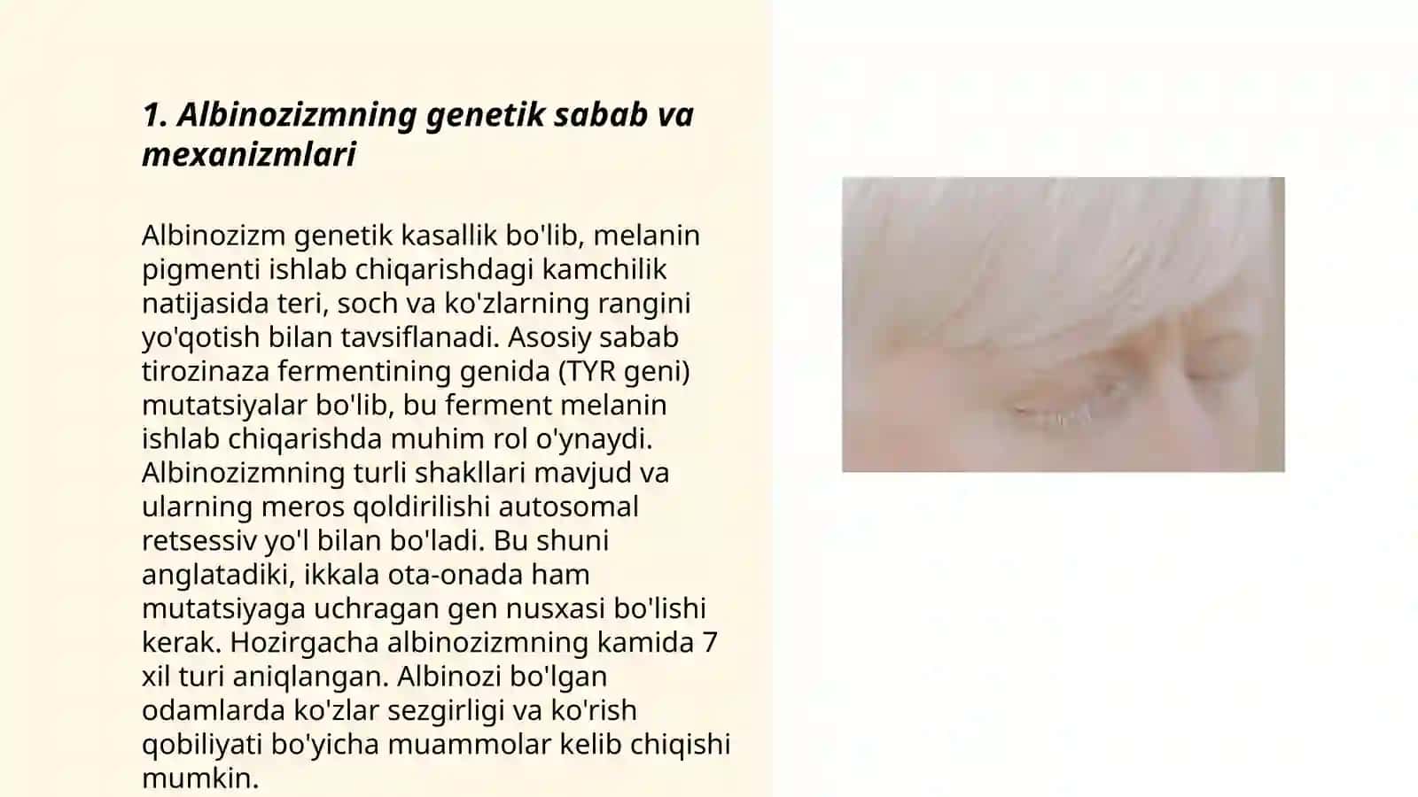 Albinozizm 3