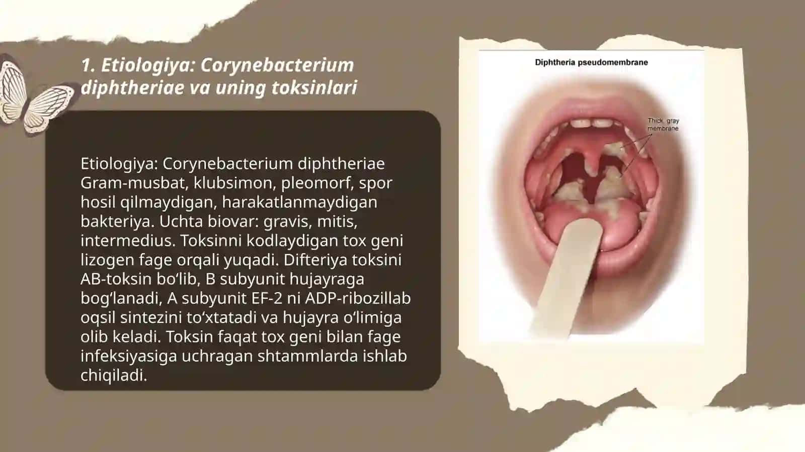Nafas olish yo'llarining difteriyasi (difteriya kurpi) 3