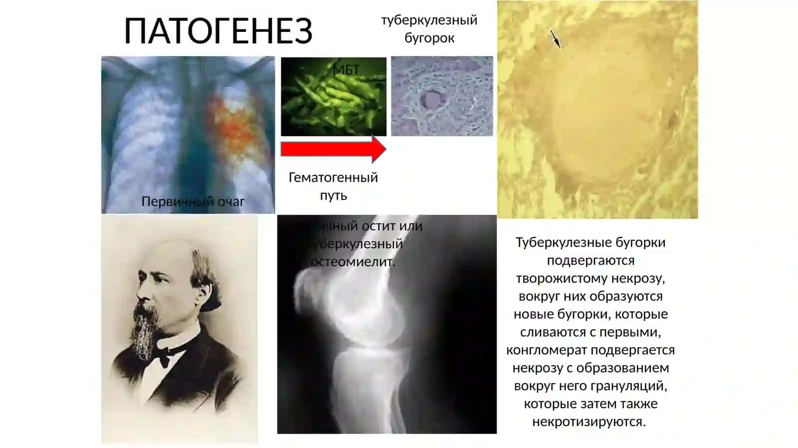 Xirurgik sil 3
