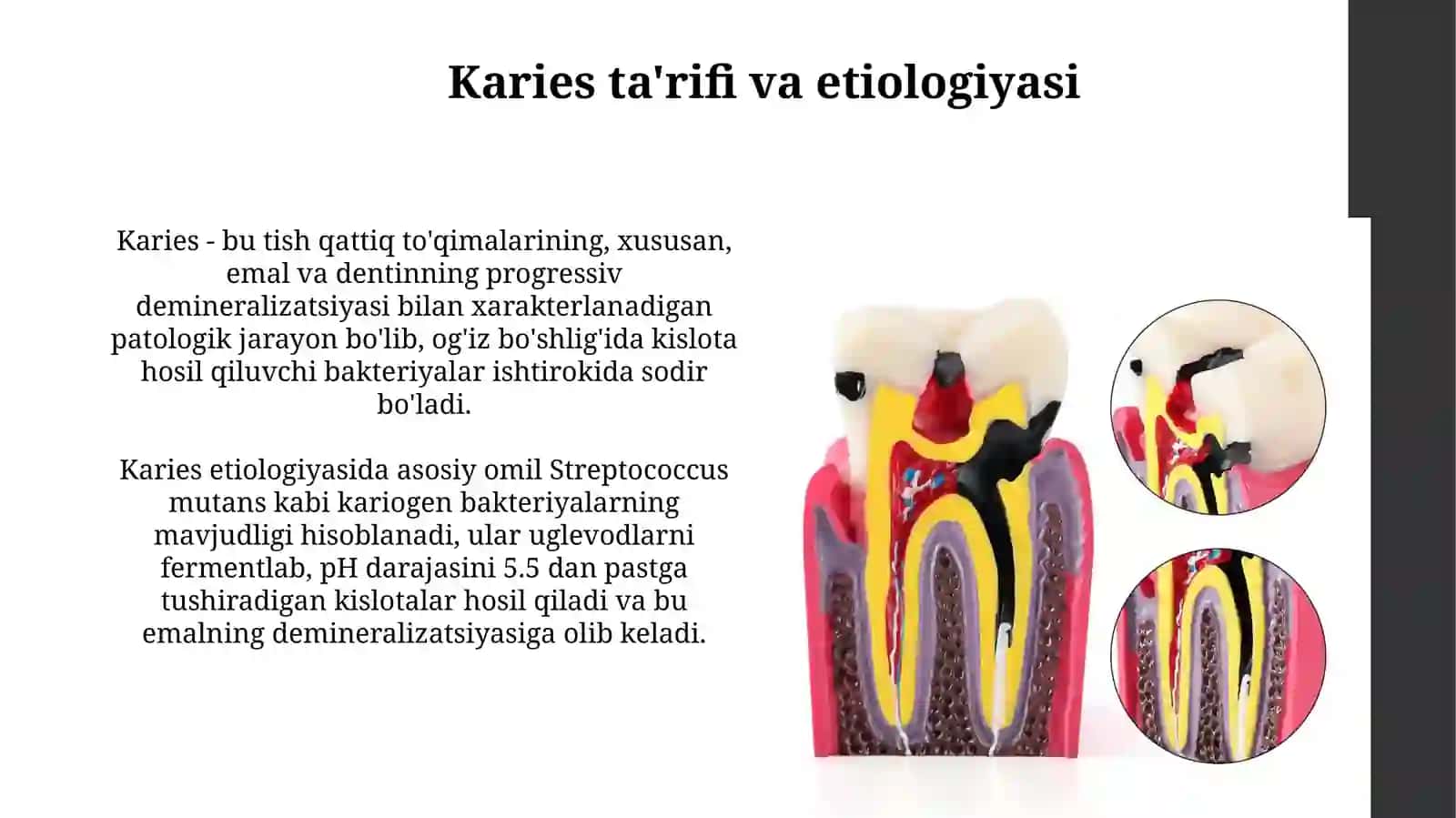 Kariesnipatalogikanatomiyasi 3