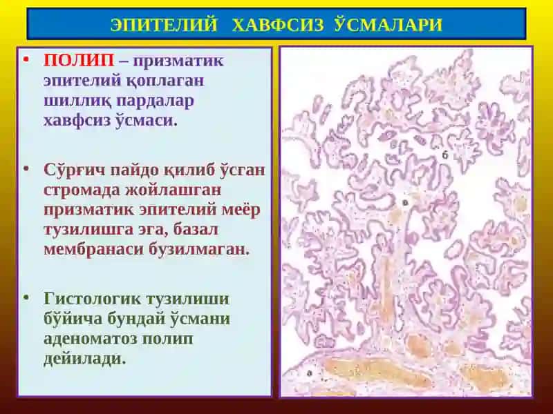 ЭПИТЕЛИЙ ХАВФСИЗЎСМАЛАРИ 3