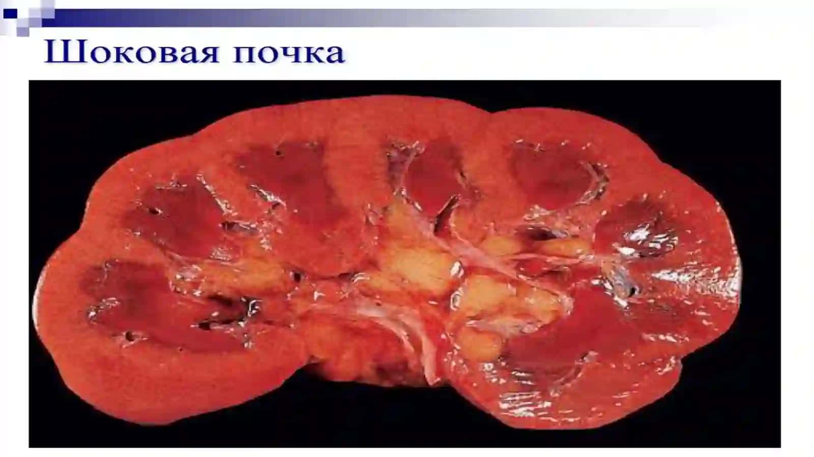 Шок 3